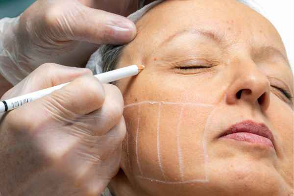 CryoPen: 5 Skin Concerns It May Be Used to Treat 4 What should you ask before having CryoPen treatment West Bridgford?