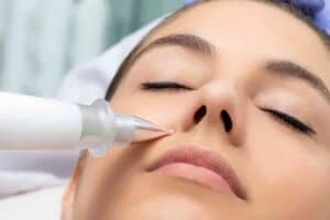 Best Actinic Keratoses Removal 3 Actinic keratoses West Bridgford solutions - book in today!