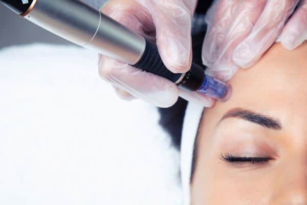 Explaining Total Skin Tightening Treatment and What to Expect 2 What Skin Concerns Can Total Skin Tightening Treatment Help With West Bridgford?